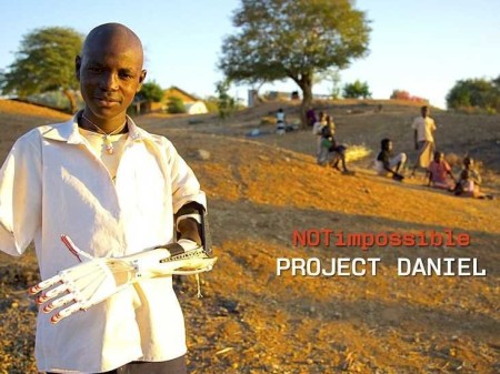 3Dプリンタを使ってスーダンの障害者に安価な義手をプレゼント　非営利団体「Not Impossible」の活動1