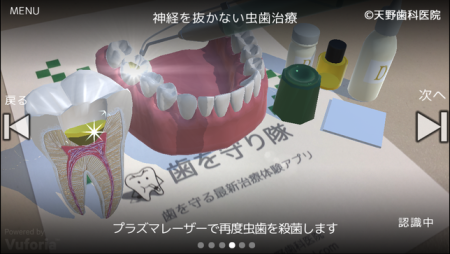 AR動画で最新歯科治療を体験　現役歯科医が製作したARアプリ「歯を守り隊」がリリース