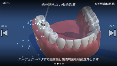 AR動画で最新歯科治療を体験　現役歯科医が製作したARアプリ「歯を守り隊」がリリース